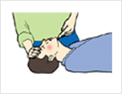 삼폐소생술 기도유지 처치방법